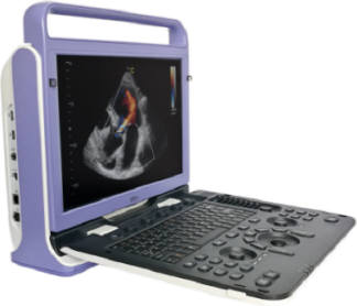 Super ECHO Color Doppler Ultrasound - APEX 4